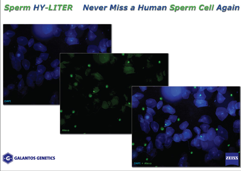 spermhyliter